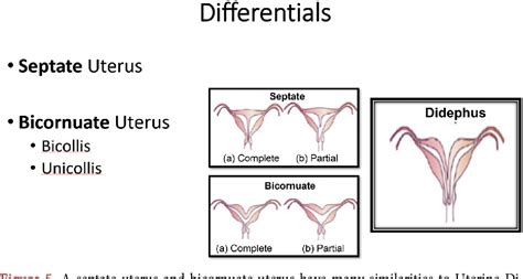 [pdf] Uterine Didelphys In A Pregnant Mother Semantic Scholar