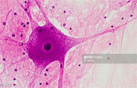 Motor Neuron --Cell Body, Dendrites and Axon, 100X. Also shows ...