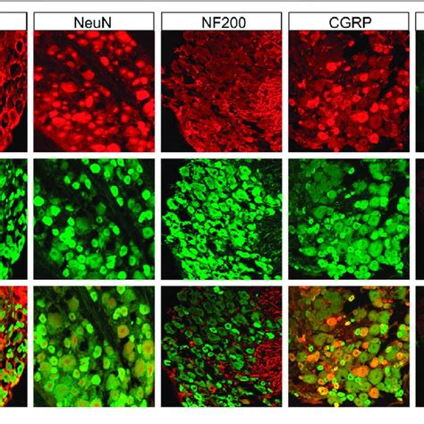 Immunofluorescence Assay Of Trpv In L Drgs Trpv Positive Drg