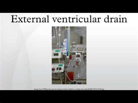 External Ventricular Drain Youtube