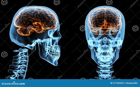 Brain Inside Skull Stock Illustration Illustration Of Brain