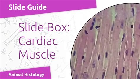 Virtual Slide Muscle Cardiac Muscle And Purkinje Fibres Youtube