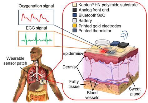 Wearable medical devices