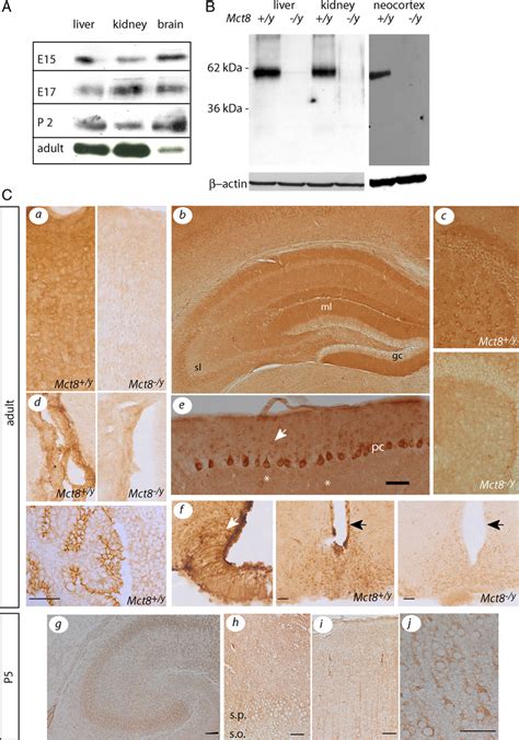 Developmental And Cell Type Specific Expression Of Mct8 Download