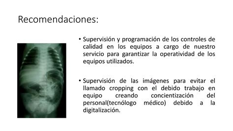 Optimizacion De Las Medidas De Proteccion Radiologica En UCI Neonatal PPT