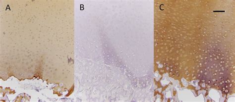 Photomicrographs Depicting Protein Expression For Collagen Type IIB