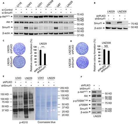 Smurf Silencing Restores Pten Expression That Ameliorates Progression