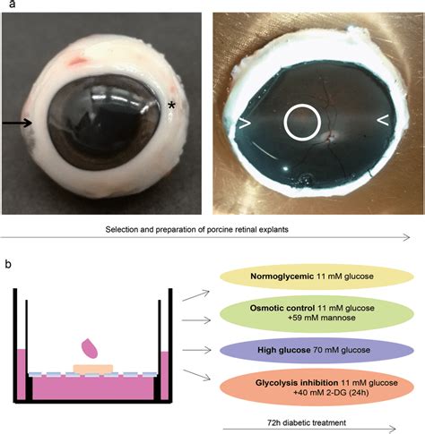 Validation In A Porcine Diabetic Retinal Explant Culture Model A