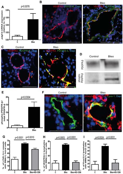 Ectopic Expression Of Pdgf B In Lymphatic Vessels And Phosphorylation