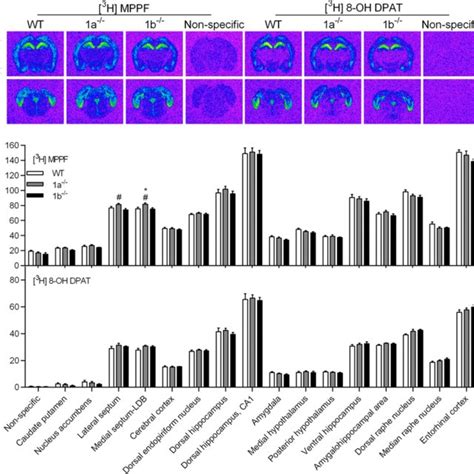 Representative Autoradiograms Of 5 Ht1a Receptor Antagonist [³h] Mppf