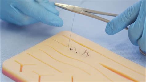 Buried Suture Technique Basic Suturing Technique Youtube