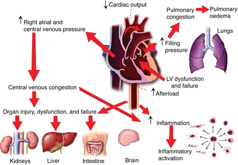 The Pathophysiology Of Hypertensive Acute Heart Failure Heart