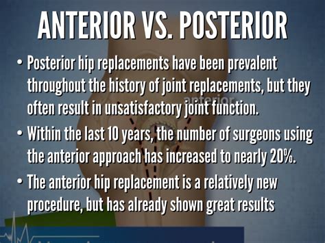 Anterior Vs Posterior Hip Surgery