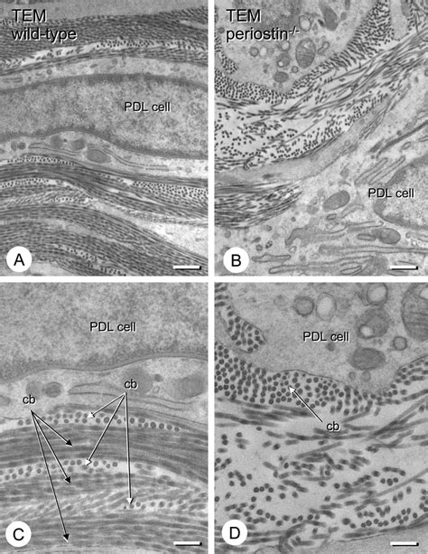 Ultrastructure Of Collagen Fibrils In Wild Type And Periostin Pdl