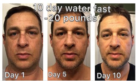 10 Day Water Only Fast Results 20 Pounds 222 To 202 Day 10 Of 100