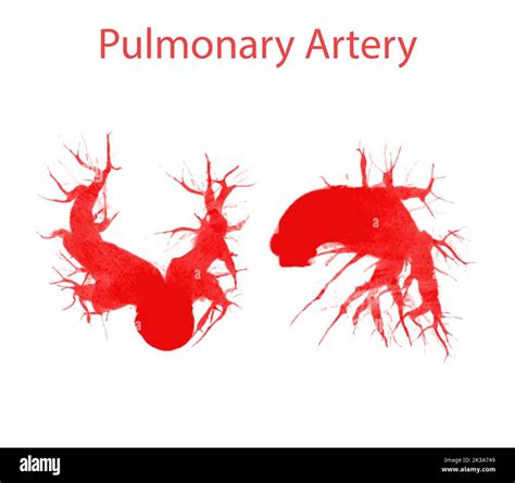 Cta Pulmonary Arteries 3d Rendering Showing Branch Of Pulmonary Artery