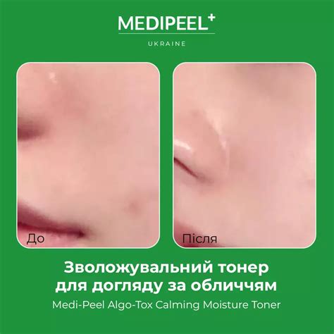 Medi Peel Algo Tox Calming Moisture Toner