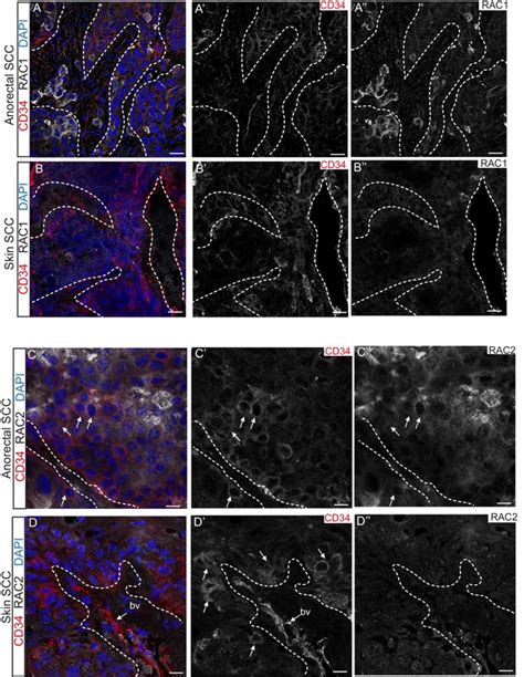 Figures and data in De-repression of the RAC activator ELMO1 in cancer ... 