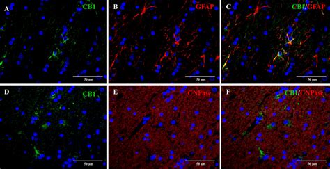 Double Immunofluorescence Staining Of The Cerebral White Matter Of A