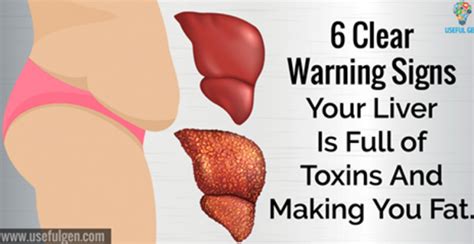 6 Signs That Your Liver Is Full Of Toxins Enna Lewis Medium