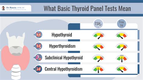 How A Thyroid Panel Can Help Evaluate Thyroid Health