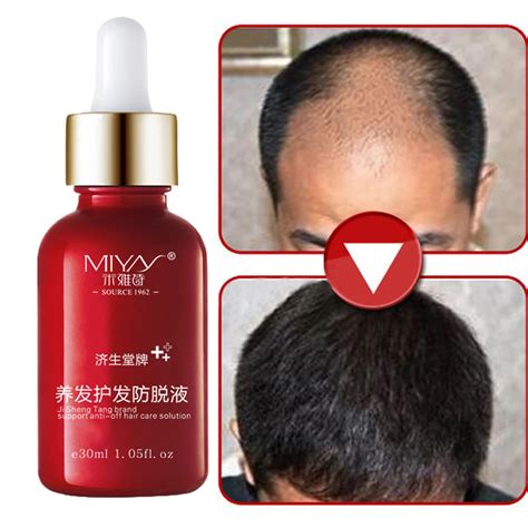 Hair Oil Hair Care Fast Powerful Hair Growth Products Regrowth Essence ...