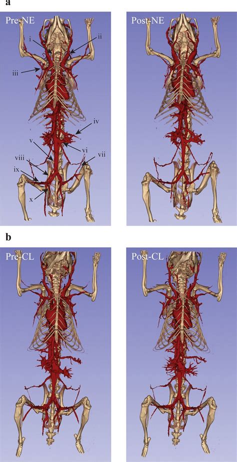 Full Body Vascular Segmentations Demonstrate The Reactivity Of Major