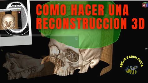 ⚠️⚠️como Hacer Una Reconstruccion 3d ️ Youtube