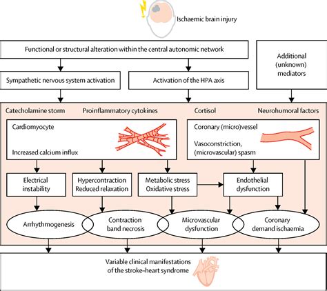 Strokeheart Syndrome Clinical Presentation And Underlying Mechanisms