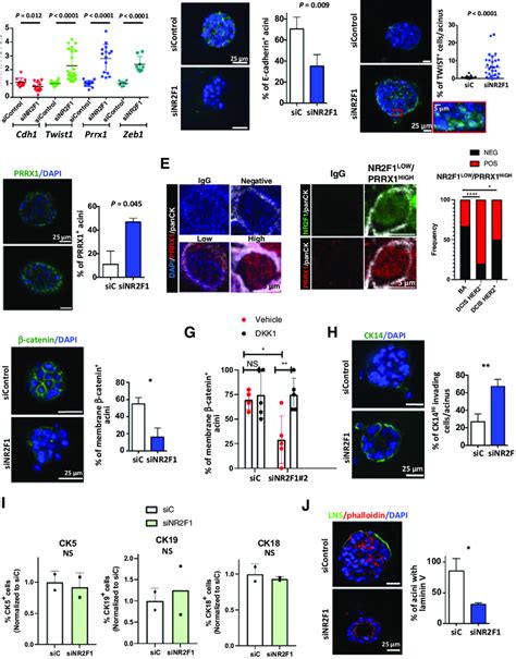 Nr F Depletion Allows A Partial Emt And Hybrid Luminal Basal Program