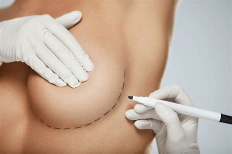 Breast Procedures Women Royalty Free Images Stock Photos