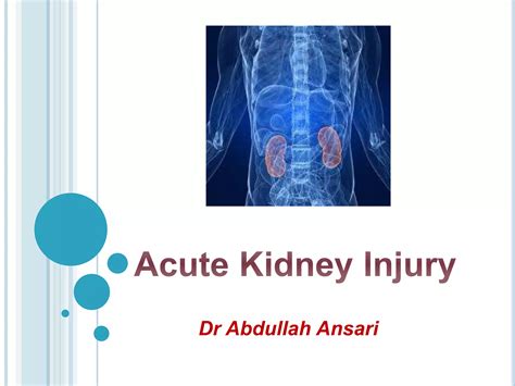 Acute Kidney Injury For Undergraduates Ppt