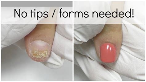 How To Fix Damaged Nail With Acrylic Youtube