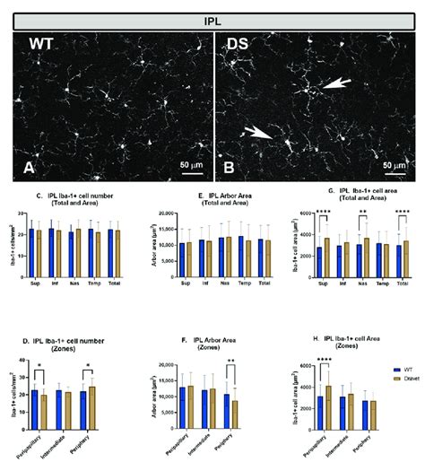 Microglial Cells In The Inner Plexiform Layer Ipl A B Retinal