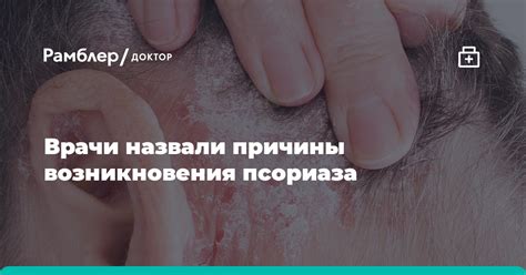 Врачи назвали причины возникновения псориаза - Рамблер/доктор