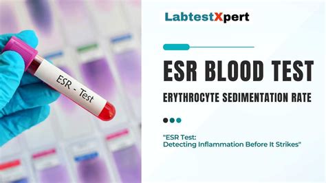 ESR Blood Test (Erythrocyte Sedimentation Rate): Your Body's Early ...