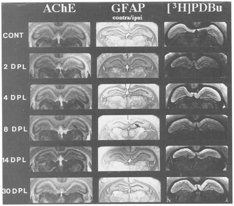 Effect of unilateral lesion of the entorhinal cortex on... | Download ...