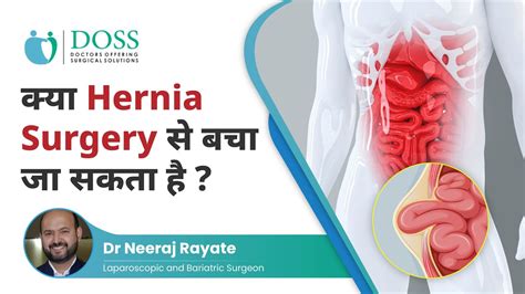 कय hernia surgery स बच ज सकत ह Hernia Treatment in Hindi Dr