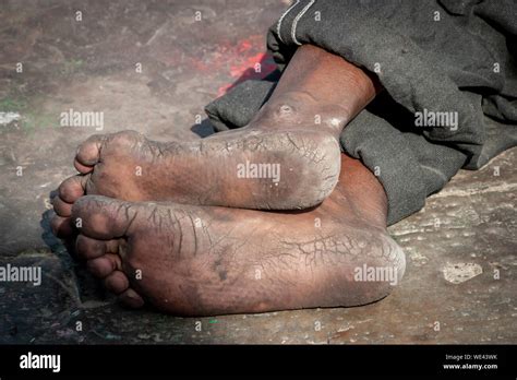 Planta De Los Pies Sucios Fotografías E Imágenes De Alta Resolución Alamy