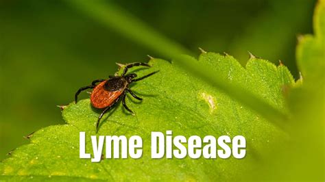 Lyme Disease Symptoms Causes Questions Answered St Michaels Elite