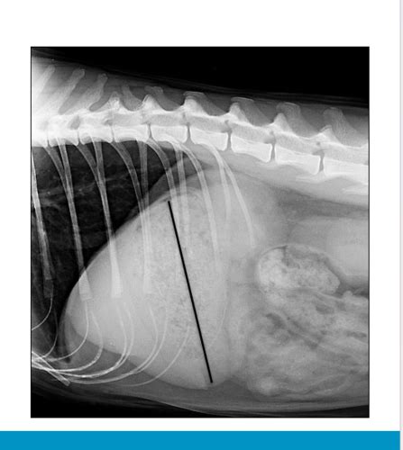 Diagn Stico Por Imagen Abdomen Gastrointestinal Flashcards Quizlet