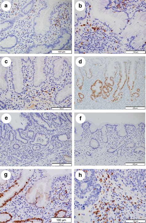 Representative Illustrations Of Immunohistochemistry Ac Lamina