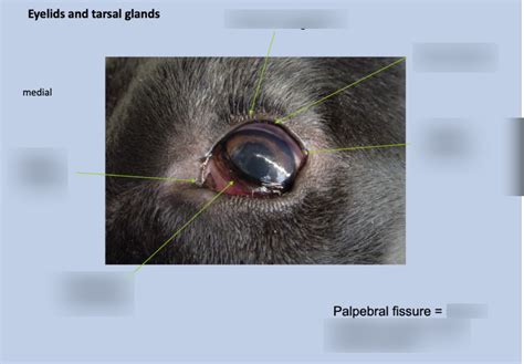 Diagram Of Eyelids And Tasal Glands Quizlet