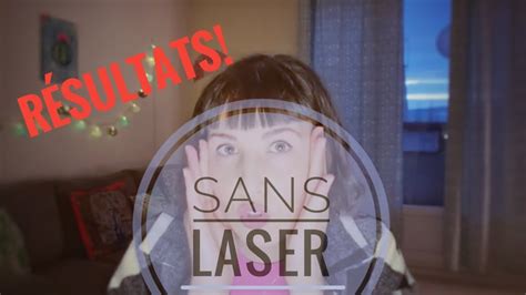 R Sultats Du D Tatouage De Mes Sourcils Sans Laser Part Youtube