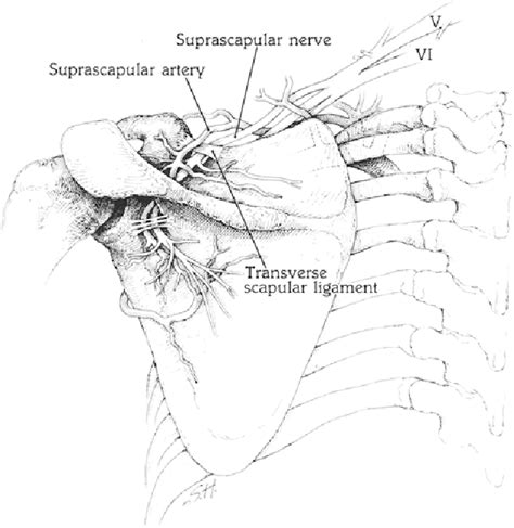 Figure 1 From Suprascapular Nerve Entrapment A Summary Of Seven Cases