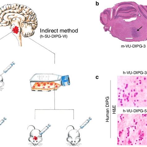 Direct And Indirect Xenotransplantation Of Human Postmortem Dipg Cells