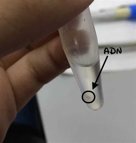 Extracción del ADN