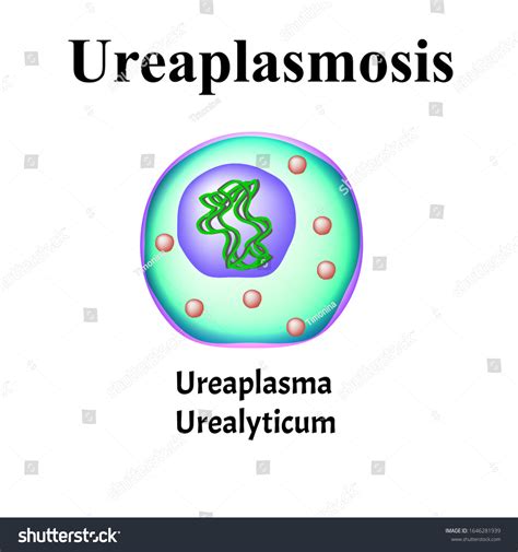Ureaplasma Urealyticum Bacterial Infections Ureaplasma Sexually Stock ...