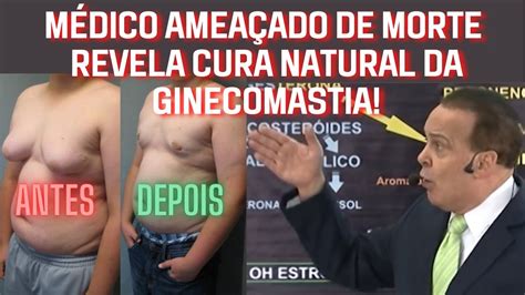 Ginecomastia Cura Natural Elimina A Ginecomastia Youtube