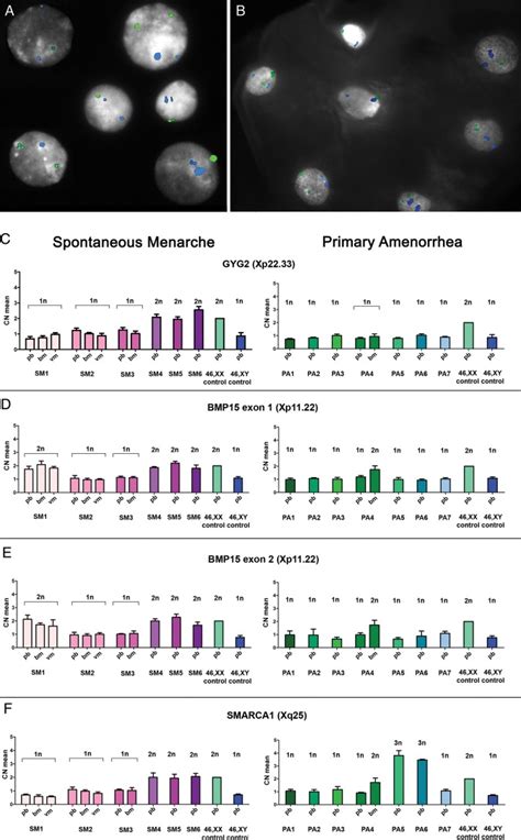 X chromosome mosaicism evaluation. In patient PA4, the euploid cell ...